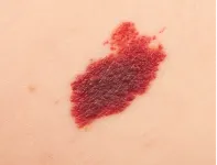 Exemple : couleur