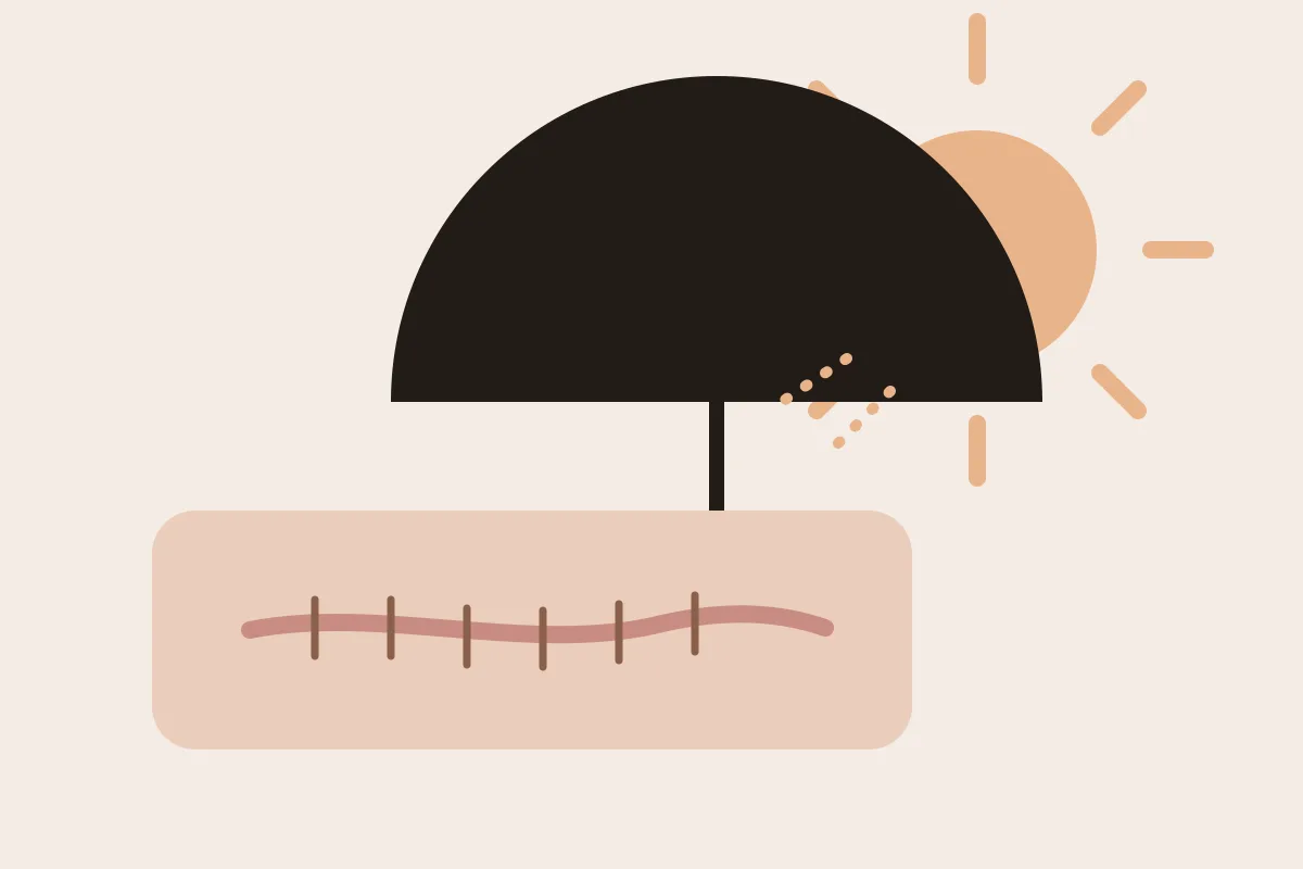 Illustration : une ombrelle protège une cicatrice du soleil