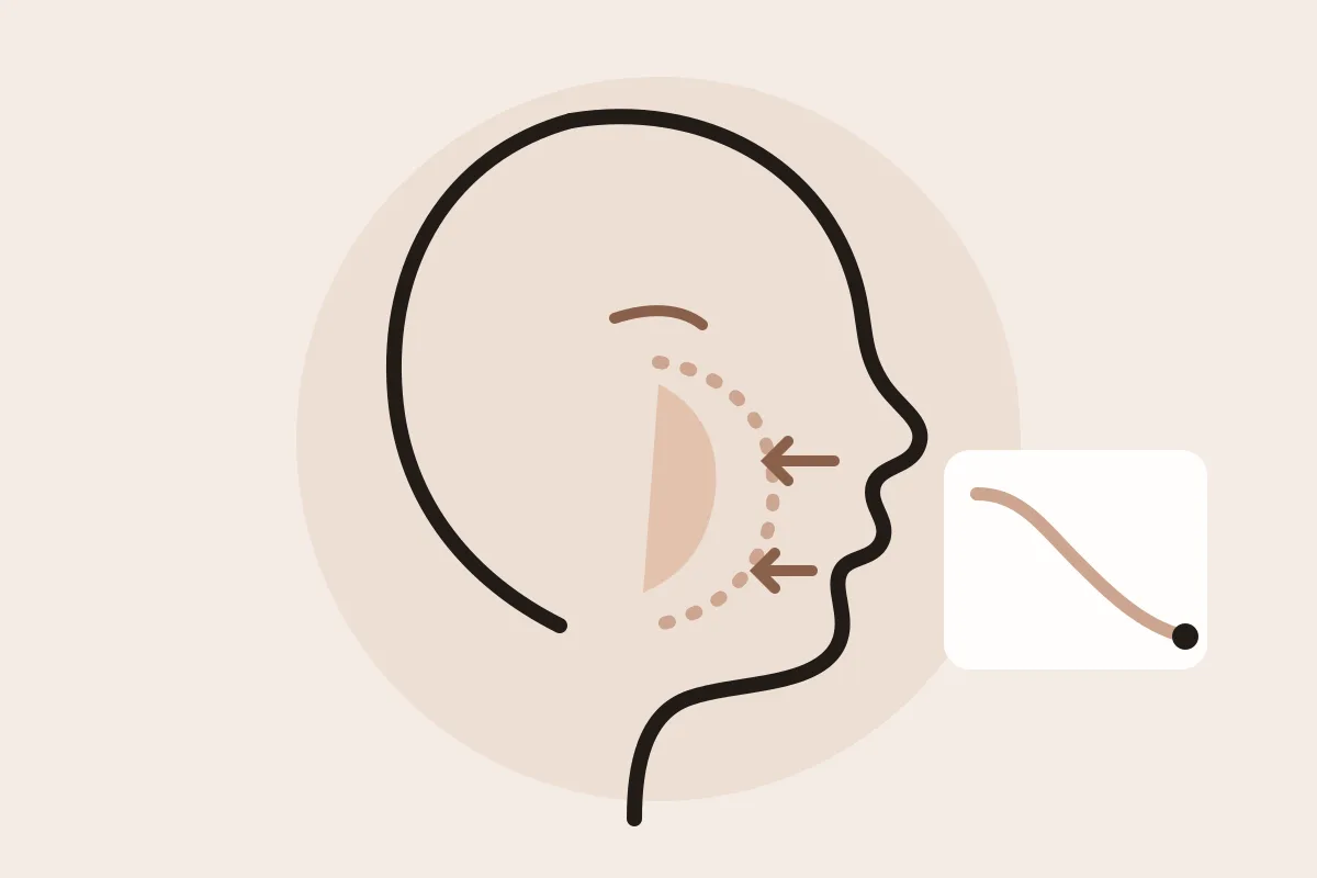 Illustration : profil de visage dont la joue se creuse après une perte de poids