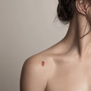 Lésion cutanée sur l’épaule