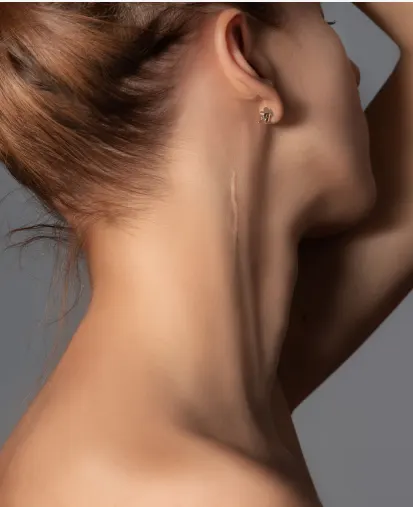 Ligne de la mâchoire et du cou